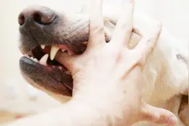 为什么狂犬病患者发作时会怕水？原因有这三点，看完可要记住了视频封面