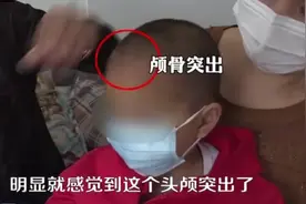 痛心！多名幼儿变“大头娃娃”，都跟喝了这种“奶粉”有关图片
