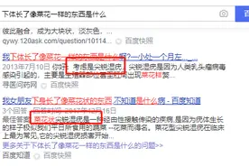 没干“坏事”，怎么也得了尖锐湿疣？可能和这几种情况有关图片