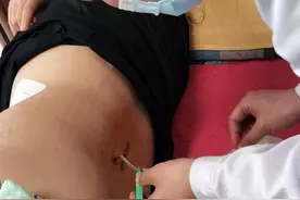 中年女子饱受“腰痛”困扰，沈阳积水潭医院“天玑”骨科手术机器人+OLIF技术显神通!图片
