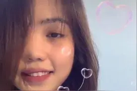 被泼硫酸毁容女也有春天，越南大美女脸部修复重拾自信，坚强生活图片