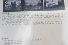 1个月淋巴结消失，3个月甲状腺恢复正常，这个方子请转给所有人图片