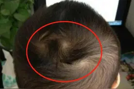 头旋多的宝宝，智商真的会更高吗？不要盲目听信谣言了图片