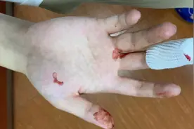 深圳市民曝大疆无人机“一键返航”成“一键炸机”，操作不当还是质量问题？图片