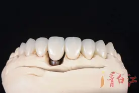 你的牙，都还在岗吗？图片