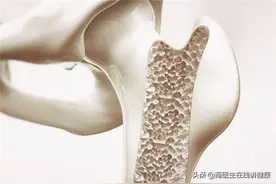 骨质疏松，钙片啥时候吃最好？会不会致肾结石？图片