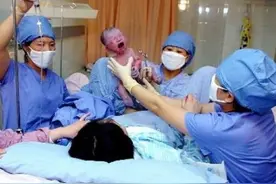 产妇刚生完宝宝只看了一眼，就说要扔掉孩子，医生和护士都笑了图片