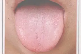 怎样通过舌头简单了解自己的身体状况图片