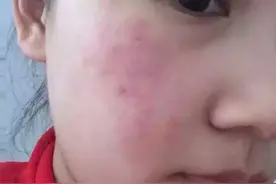 化妆品中的常见过敏源，早些了解就能少踩坑图片