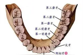 智齿真的得拔掉吗？拔智齿前你必须知道的4件事，牙医的真心总结图片