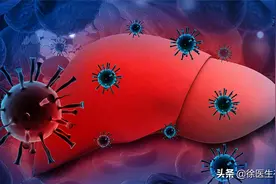 乙肝严不严重，不是看表面抗原和病毒DNA：你需要看这些检查图片