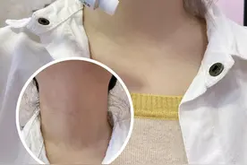 去颈纹方法分享啦图片