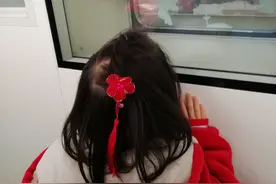 陕西西安9岁姐姐患上再生障碍性贫血，4岁妹妹骨髓移植救姐姐，不哭不闹还鼓励姐姐“加油”图片