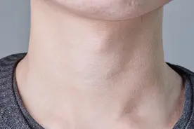 脖子上长出一颗颗小肉粒，是啥东西？是不是老人说的“富贵包”？图片