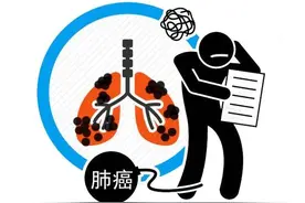 肺不好，嘴先知！医生提醒：出现这些症状，尽快检查肺CT图片