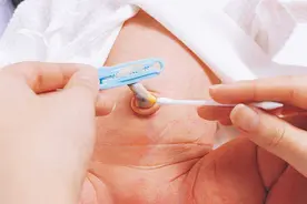 新生儿脐带多久掉？脐带护理的3个注意事项图片
