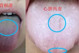 身上没劲肚子胀，大便不成型，齿痕舌脾虚中成药有哪些图片