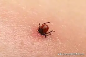 夏季多蚊虫，被虫子叮咬了应该怎么办？图片