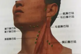 关于淋巴结肿大的科普知识图片
