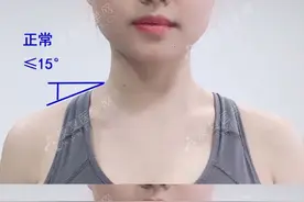 造成“虎背熊腰”的原因都在这，医生告诉你怎么解决图片