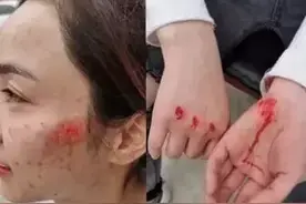 姑娘！你的脸……心疼！图片