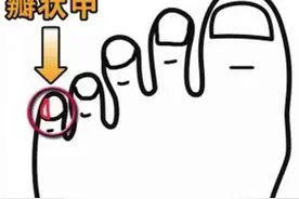 周围脚趾上的小趾甲分成两瓣的人，他们究竟什么特殊来历？图片