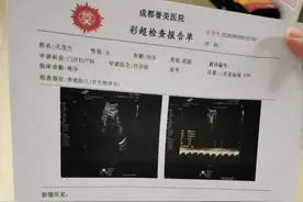 我的经历剖腹产详细过程，给各位即将生产的妈妈一个参考图片