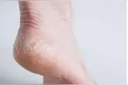肝功能下降时，脚上通常有5种“表现”，快看看自己有没有中招图片