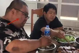 大胃王美食博主胖子症状比泡泡龙还严重！脸上和胳膊都出现黑斑图片