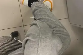 可怕！一男子脊柱拧成"麻花"，竟是因为跷二郎腿！很多人还在做图片