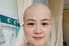 岳云鹏妻子郑敏被曝患病，自曝光头照后，首次回应病情图片