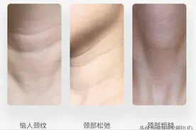 夏天到了，颈纹才是显老敌人！有效预防和淡化颈纹我全靠它了图片