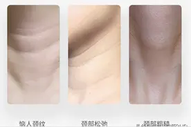 夏天到了，颈纹才是显老敌人！有效预防和淡化颈纹我全靠它了图片