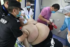 胖到无法呼吸，疫情期间体重狂长200斤，医生说减肥只有一个办法图片