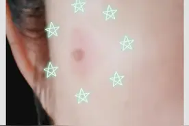小偏方去斑，亲身体验第七天，看看效果咋样？图片