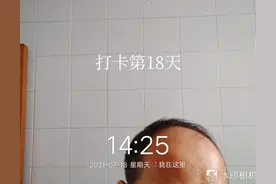 挑战100天长出新头发（18）图片