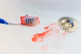 牙龈出血就是因为缺少维生素C？图片