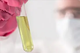尿常规检查，查出尿糖有一个加号？尿糖1+与尿糖4+哪一个更严重？图片
