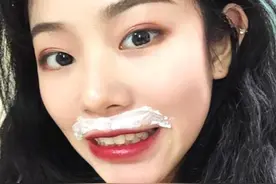 嘴唇“长胡子”的女生，多半都爱做这“3件事”，别再不当回事了图片