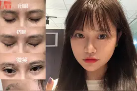 接二连三入坑黑医美，主播惨为所谓“纯韩技术”“亚洲眼王”买单图片