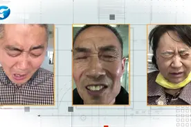 河南省直第三人民医院刘现忠：鲜为人知的梅杰综合征图片