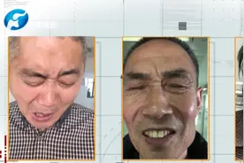 河南省直第三人民医院刘现忠：鲜为人知的梅杰综合征图片
