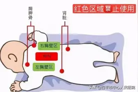 扣背排痰，你做对了吗？图片