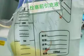 深圳首例！介入微创法成功治疗顽固性淋巴漏患者图片