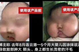 婴儿面霜被曝激素超标致“大头娃娃”官方：已责令涉事企业召回涉事产品图片