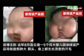 婴儿面霜被曝激素超标致“大头娃娃”官方：已责令涉事企业召回涉事产品图片