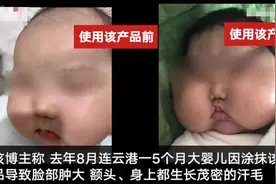 婴儿面霜被曝激素超标致“大头娃娃”官方：已责令涉事企业召回涉事产品图片