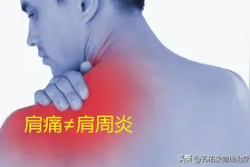 肩膀疼痛是咋回事？为啥不是肩周炎？本文告知您原因图片