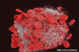 心血管患者福音：阿司匹林替代药上市，出血风险低、胃肠反应小图片