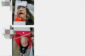 令人发指！4岁女童遭继母虐至重伤送ICU！警方：继母对伤害事实供认不讳图片
